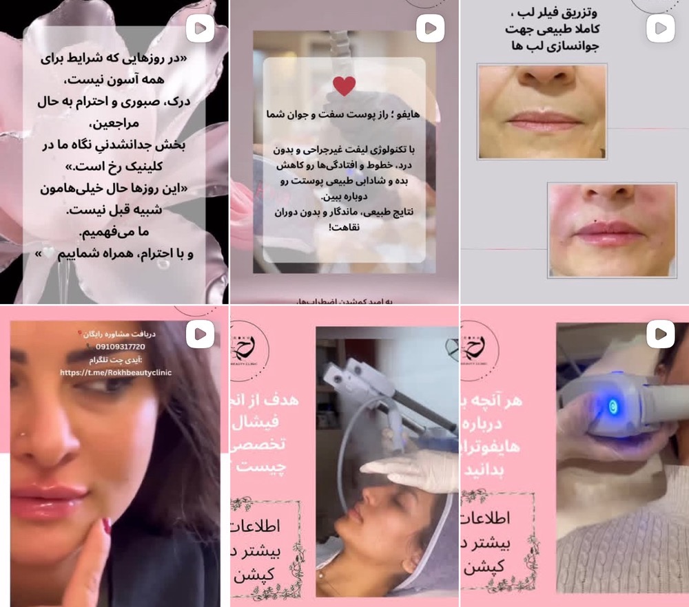بهترین فیشیال و پاکسازی پوست در عظیمیه