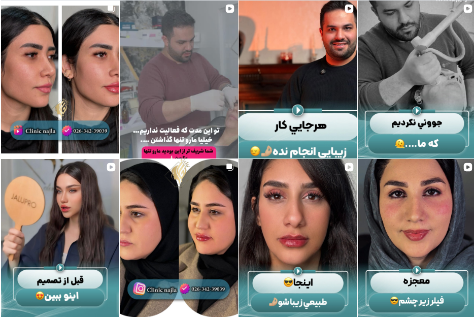 بهنرین مرکز فیشیال و پاکسازی پوست در فردیس