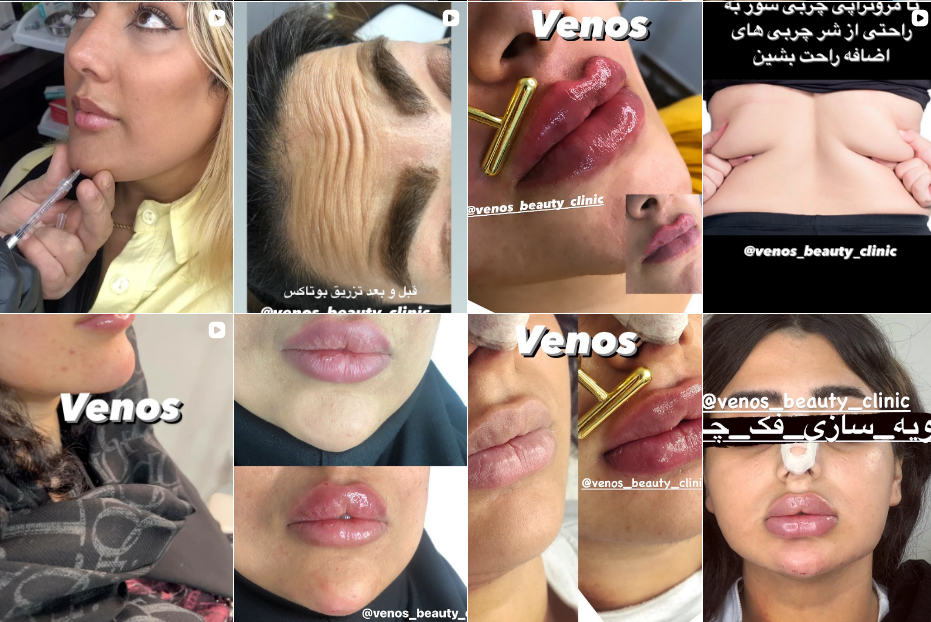 فیشیال پوست در فردیس
