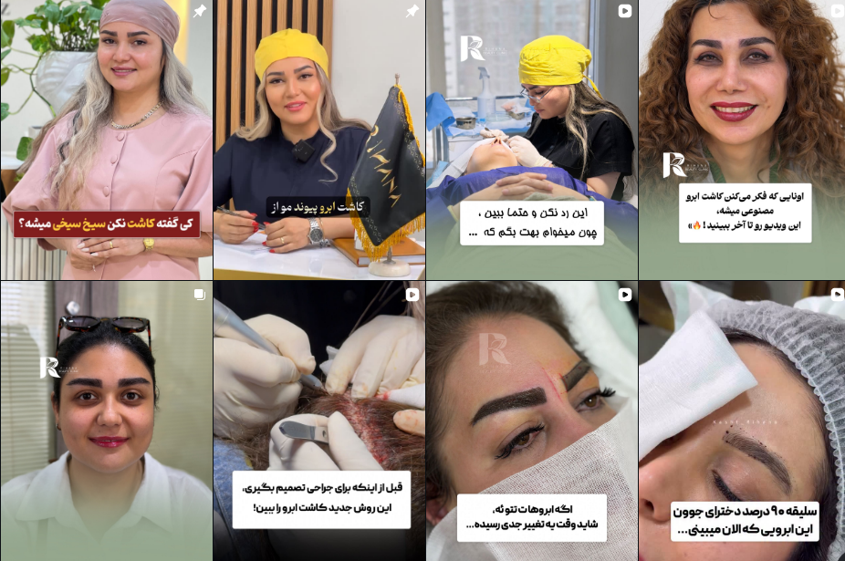 کاشت ابرو در گوهردشت