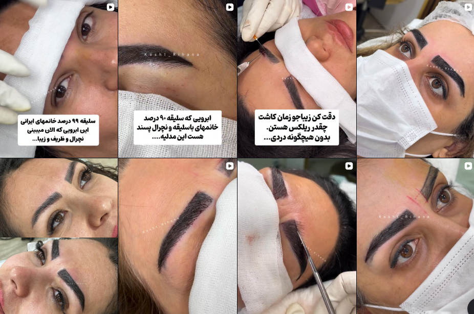 بهترین مرکز کاشت ابرو در گوهردشت