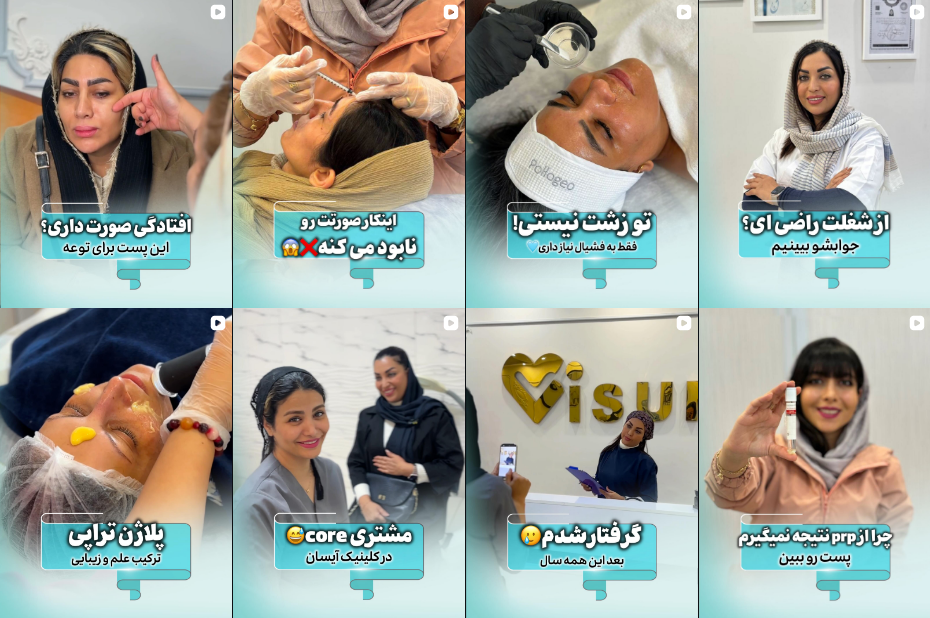 کلینیک کاشت ابرو در گوهردشت