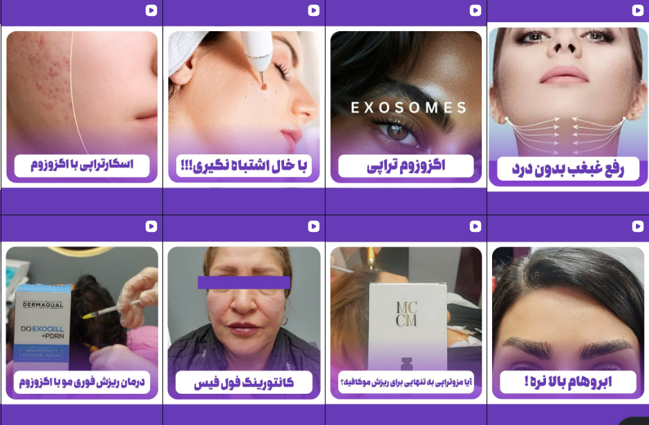 برترین مرکز مزوتراپی در کرج